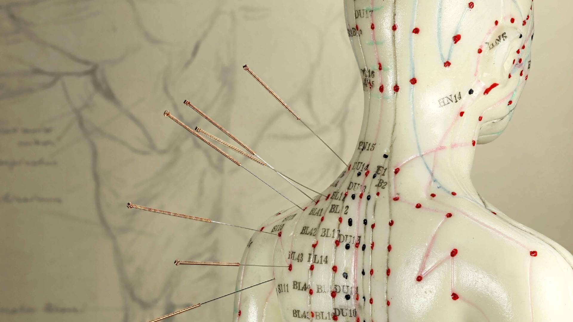 Acupuncture Surrey