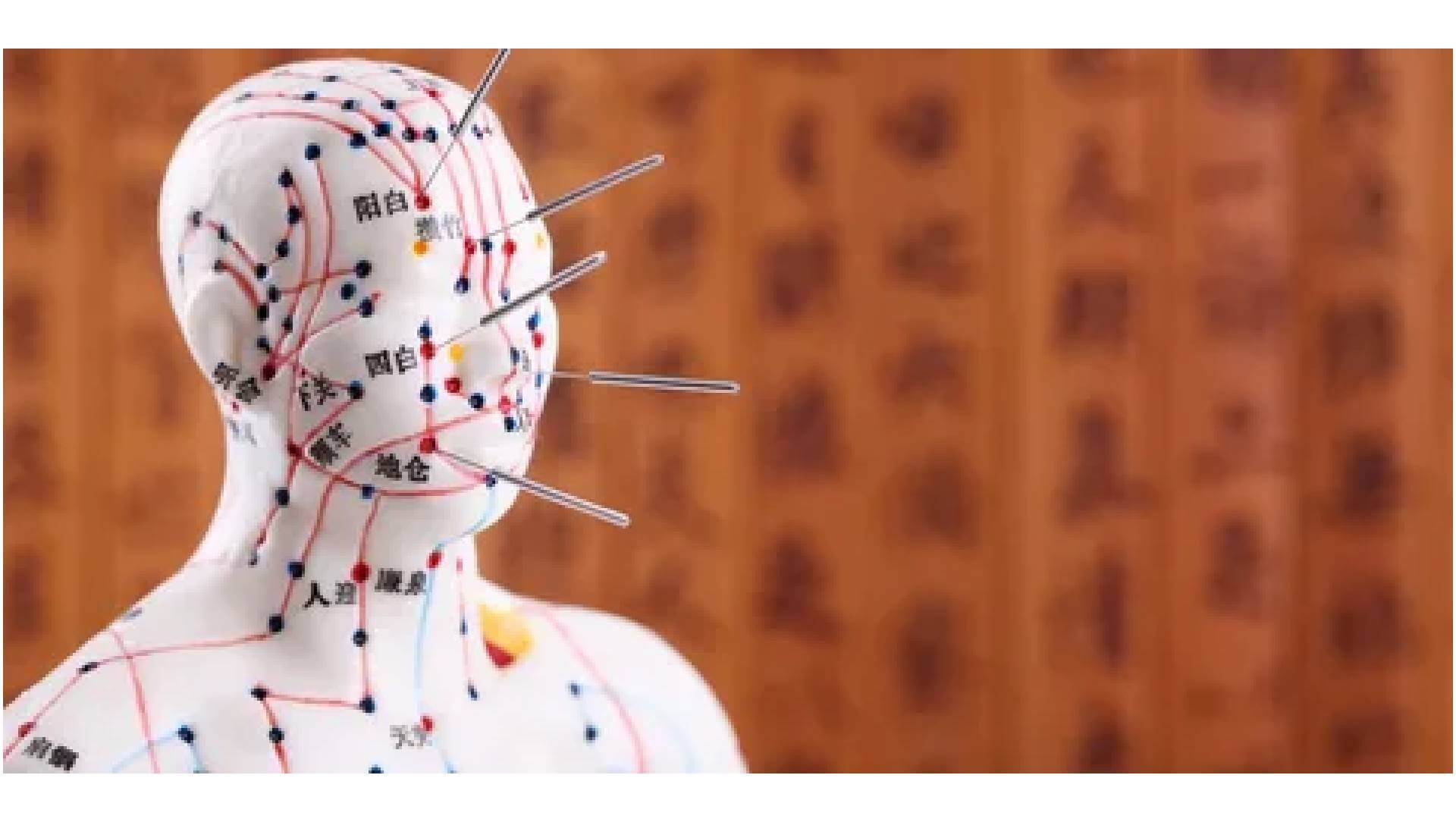 Acupuncture Surrey
