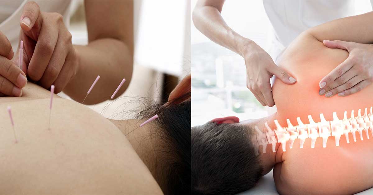 Acupuncture vs Chiropractic Which Is Right for Your Health Needs