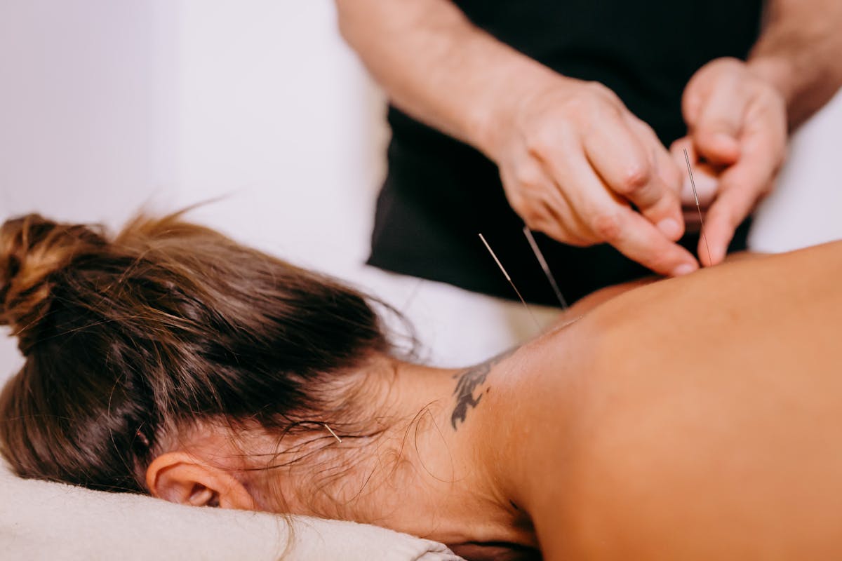 how does acupuncture work for pain relief