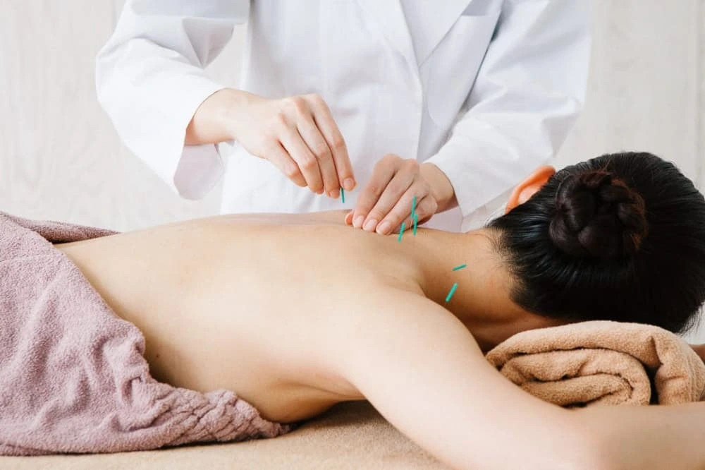 what to do after acupuncture​