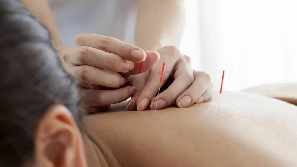 Acupuncture for Seasonal Allergies: Relief During Canadian Spring & Fall
