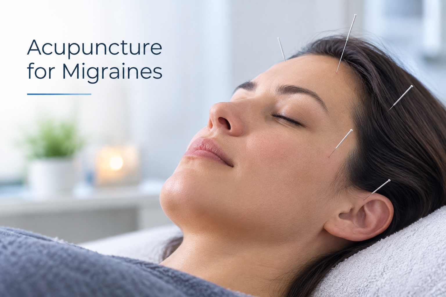 acupuncture for migraines